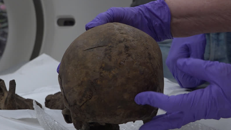 Medieval men undergo a CT scan in Dordt’s hospital